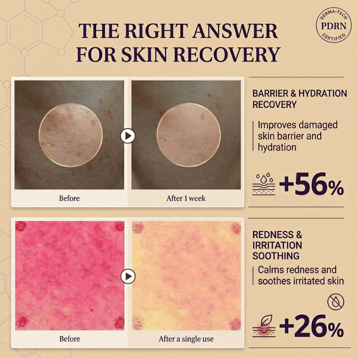 Korean Expert Madeca Cream PDRN