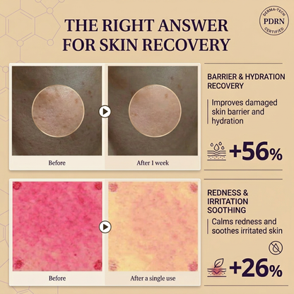Korean Expert Madeca Cream PDRN