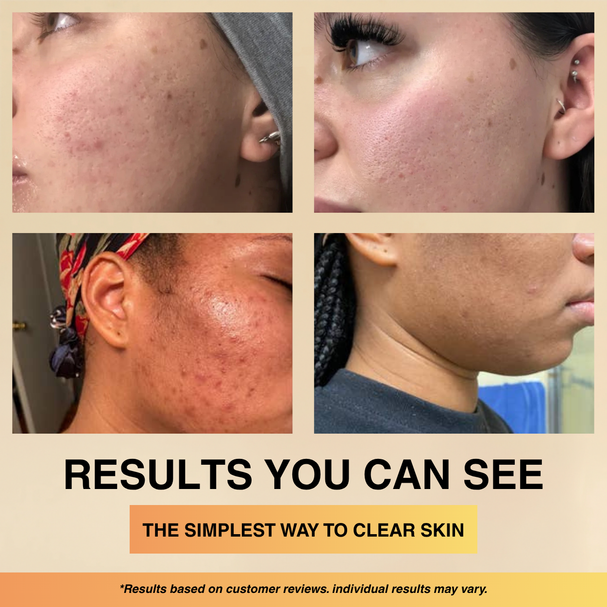 Rice Peel Shot Glow Exfoliating Serum
