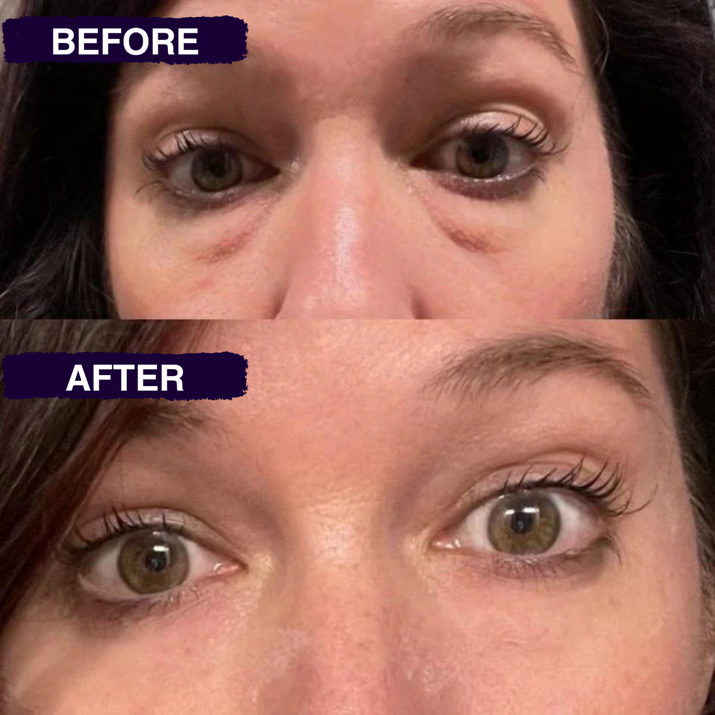 Instant Firm Collagen Eye Patches