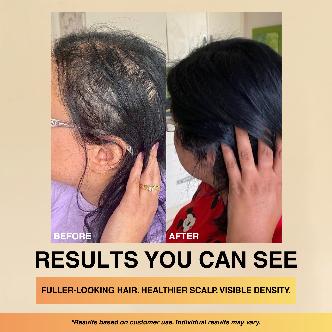 Hair Growth Serum - Scalp Revitilizing Solution