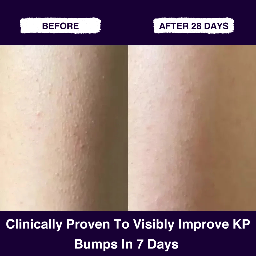 Glycolic Acid Exfoliating Body Stick