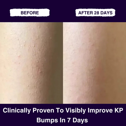 Glycolic Acid Exfoliating Body Stick