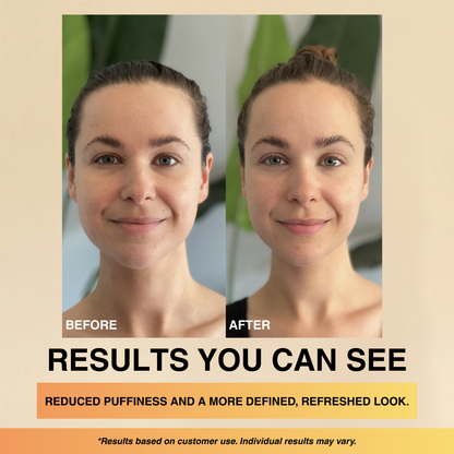 Lymphatic Drainage Drop