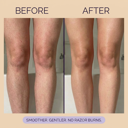 Smooth Hair Removal Mousse