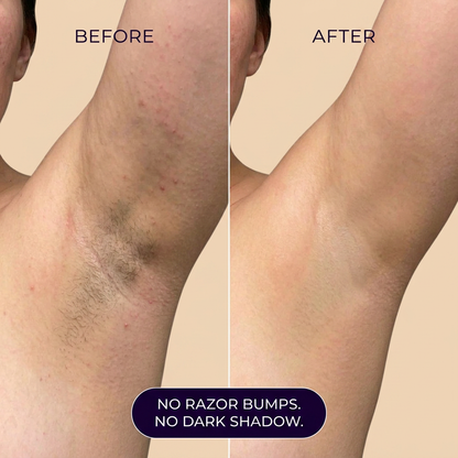 Smooth Hair Removal Mousse