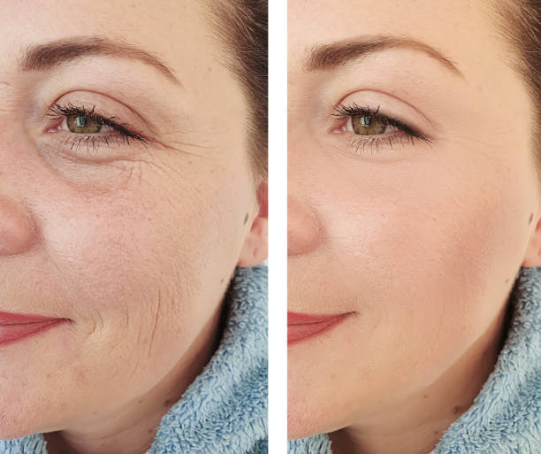 skin comparison
