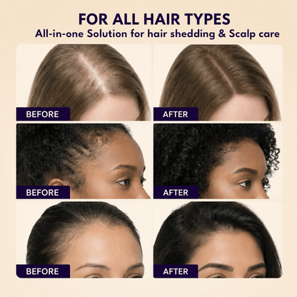 Hair Growth Serum